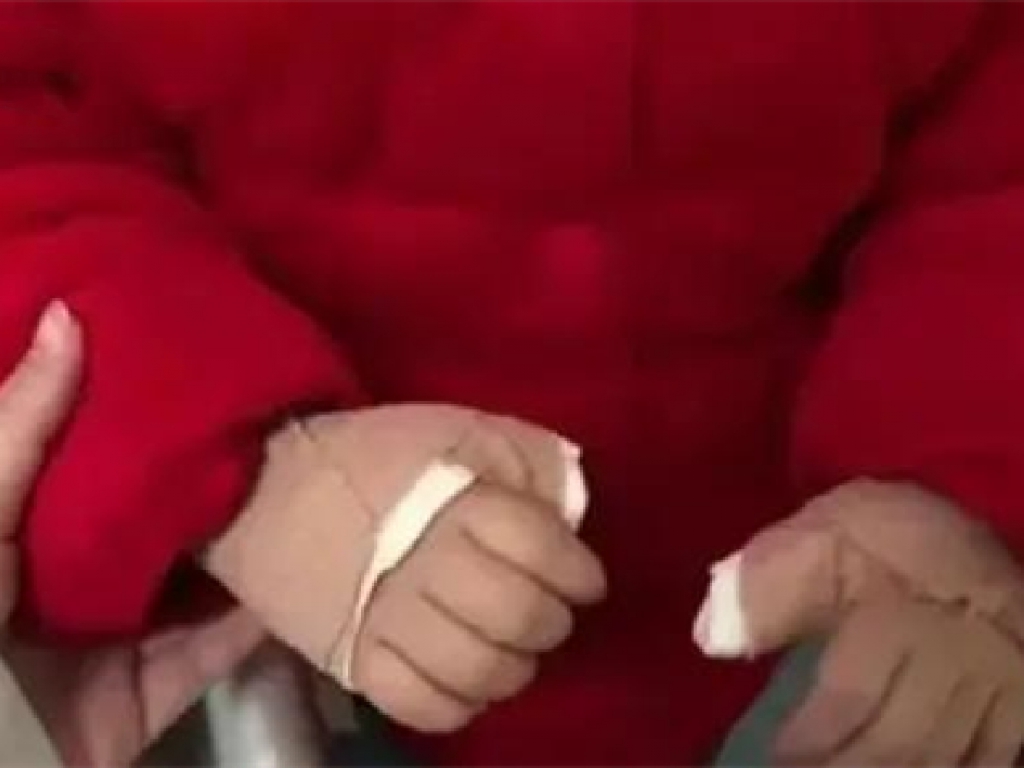 家長們，別再把手機當“哄娃利器”，3歲娃因此手指僵硬伸不直